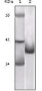 Cyclin-dependent kinase inhibitor 2A, isoform 1 antibody, abx016046, Abbexa, Enzyme Linked Immunosorbent Assay image 