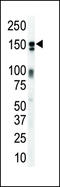 Erb-B2 Receptor Tyrosine Kinase 3 antibody, LS-C97504, Lifespan Biosciences, Western Blot image 