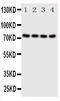 P21 (RAC1) Activated Kinase 6 antibody, PA1729, Boster Biological Technology, Western Blot image 