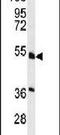 Hepatocyte Nuclear Factor 4 Alpha antibody, PA5-12370, Invitrogen Antibodies, Western Blot image 