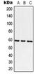 Arginyltransferase 1 antibody, LS-C353807, Lifespan Biosciences, Western Blot image 
