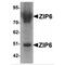 Solute Carrier Family 39 Member 6 antibody, MBS150870, MyBioSource, Western Blot image 