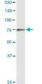 Cytochrome P450 Oxidoreductase antibody, H00005447-D01P, Novus Biologicals, Western Blot image 