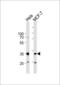 Snail Family Transcriptional Repressor 1 antibody, GTX82509, GeneTex, Western Blot image 