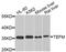 Transcription elongation factor, mitochondrial antibody, PA5-76409, Invitrogen Antibodies, Western Blot image 