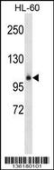 Glycosylphosphatidylinositol Specific Phospholipase D1 antibody, 58-803, ProSci, Western Blot image 