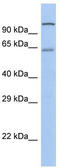Hepatocyte Nuclear Factor 4 Alpha antibody, TA329711, Origene, Western Blot image 
