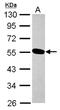 Ubiquitin Conjugating Enzyme E2 O antibody, NBP2-20787, Novus Biologicals, Western Blot image 