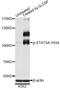 Signal Transducer And Activator Of Transcription 5A antibody, MBS128520, MyBioSource, Western Blot image 
