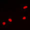 Myocyte Enhancer Factor 2A antibody, LS-C358804, Lifespan Biosciences, Immunofluorescence image 