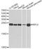 Ribosomal Protein L9 antibody, STJ28489, St John