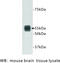 Transmembrane Protein 132A antibody, MBS355118, MyBioSource, Western Blot image 