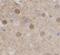 ADP Ribosylation Factor GTPase Activating Protein 1 antibody, FNab10028, FineTest, Immunohistochemistry paraffin image 