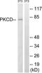 Protein Kinase C Delta antibody, LS-B11341, Lifespan Biosciences, Western Blot image 