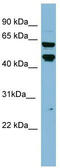 Prolyl 4-Hydroxylase, Transmembrane antibody, TA344617, Origene, Western Blot image 