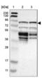 Cytoskeleton Associated Protein 2 antibody, NBP1-84602, Novus Biologicals, Western Blot image 