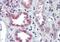 Snail Family Transcriptional Repressor 1 antibody, NB100-53787, Novus Biologicals, Immunohistochemistry paraffin image 