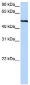 Thyroid Hormone Receptor Interactor 6 antibody, TA339223, Origene, Western Blot image 
