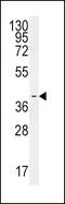 Spermine Synthase antibody, PA5-25777, Invitrogen Antibodies, Western Blot image 