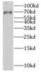 La Ribonucleoprotein Domain Family Member 7 antibody, FNab04700, FineTest, Western Blot image 