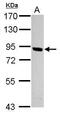Patatin Like Phospholipase Domain Containing 8 antibody, PA5-32006, Invitrogen Antibodies, Western Blot image 