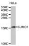 Small Ubiquitin Like Modifier 1 antibody, abx001742, Abbexa, Western Blot image 