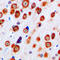 Glutamate Metabotropic Receptor 5 antibody, LS-C352288, Lifespan Biosciences, Immunohistochemistry paraffin image 