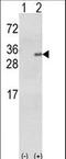 Glutathione S-Transferase Alpha 1 antibody, LS-C166702, Lifespan Biosciences, Western Blot image 