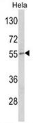 Gasdermin E antibody, AP17278PU-N, Origene, Western Blot image 