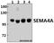 Semaphorin 4A antibody, A06779, Boster Biological Technology, Western Blot image 