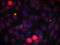 ETS Transcription Factor ELK1 antibody, STJ22126, St John