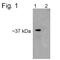 Proteasome 26S Subunit, Non-ATPase 7 antibody, NB120-11436, Novus Biologicals, Western Blot image 