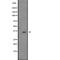 Trio Rho Guanine Nucleotide Exchange Factor antibody, PA5-67855, Invitrogen Antibodies, Western Blot image 