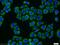 Calcium/Calmodulin Dependent Protein Kinase Kinase 2 antibody, 11549-1-AP, Proteintech Group, Immunofluorescence image 