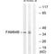 LRAT Domain Containing 2 antibody, A13540, Boster Biological Technology, Western Blot image 