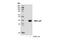 2'-5'-Oligoadenylate Synthetase 1 antibody, 14498S, Cell Signaling Technology, Western Blot image 