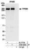 Tetratricopeptide Repeat Domain 28 antibody, A304-636A, Bethyl Labs, Immunoprecipitation image 