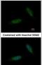 TBC1 Domain Containing Kinase antibody, PA5-34789, Invitrogen Antibodies, Immunofluorescence image 