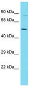 Coronin 1C antibody, TA331387, Origene, Western Blot image 