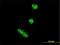 Twist Family BHLH Transcription Factor 1 antibody, H00007291-M04, Novus Biologicals, Immunocytochemistry image 