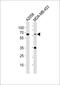 CD63 Molecule antibody, 61-885, ProSci, Western Blot image 