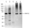 ATP Binding Cassette Subfamily D Member 3 antibody, PA1-1650, Invitrogen Antibodies, Western Blot image 