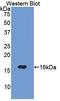 Semaphorin 3A antibody, LS-C304820, Lifespan Biosciences, Western Blot image 