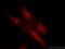 Transmembrane protein 127 antibody, 23142-1-AP, Proteintech Group, Immunofluorescence image 