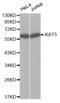 Lysine Acetyltransferase 5 antibody, abx001864, Abbexa, Western Blot image 