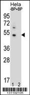 DnaJ Heat Shock Protein Family (Hsp40) Member B6 antibody, 56-462, ProSci, Western Blot image 