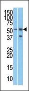 URI1 Prefoldin Like Chaperone antibody, PA5-11806, Invitrogen Antibodies, Western Blot image 