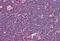 Interleukin 31 antibody, MBS240345, MyBioSource, Immunohistochemistry paraffin image 