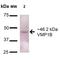 Transmembrane protein 49 antibody, LS-C773823, Lifespan Biosciences, Western Blot image 