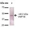 Vacuole Membrane Protein 1 antibody, LS-C773823, Lifespan Biosciences, Western Blot image 